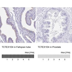 TCTEX1D4 Antibody, Novus Biologicals 25 &mu;L, Unlabeled:Antibodies, Polyclonal